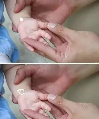 小儿推拿大全,解决宝宝各症状,赶紧收藏