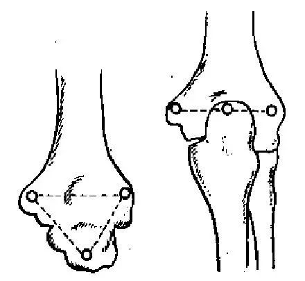 骨科8大部位特殊检查方法及技巧汇总看看你掌握了多少