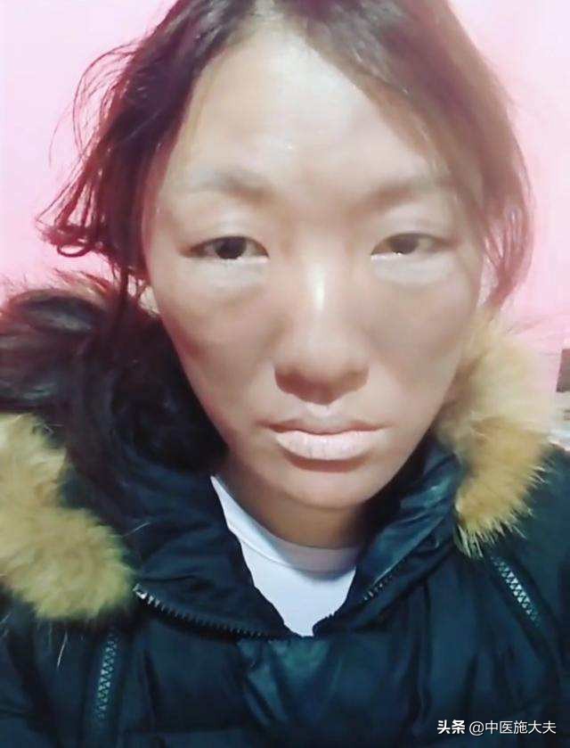 農村來的女精神病人喝了三天中藥桃核承氣湯忽然懂得害羞