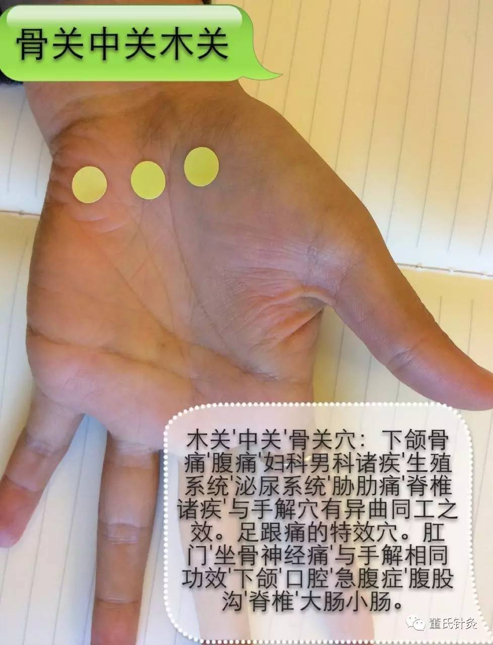 董氏针灸培训班课堂分享之骨关,木关,中关穴!
