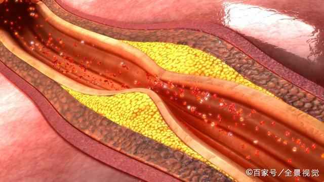 还会加速血液流动,帮助促进身体新陈代谢,提高免疫力,加速血管中毒素
