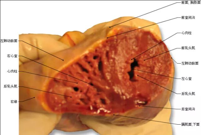 心底,冠狀動脈溝,右心房,動脈圓錐及漏斗,右心室,心頂,心尖切跡右心耳