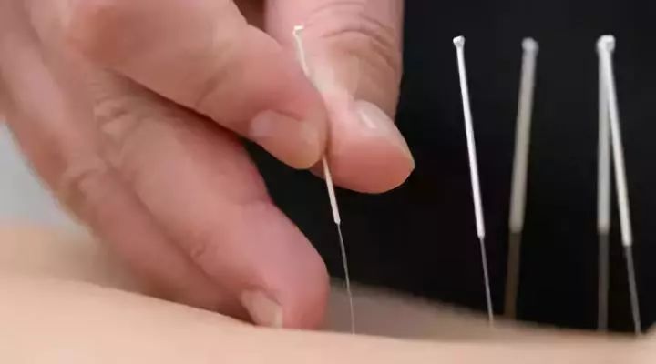 10,自闭:舌针心穴,神根穴(舌底下系带根部凹陷中),日2次.6次为1疗程.