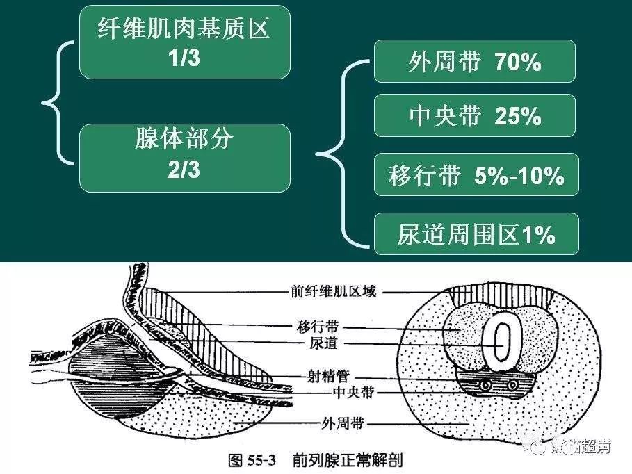 前列腺及前列腺周围囊肿