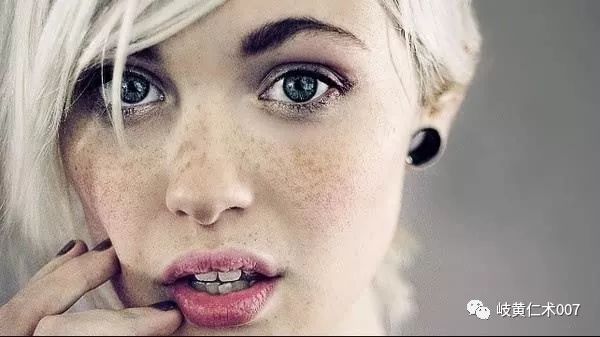 有斑必有瘀无瘀不成斑附玫瑰祛斑汤