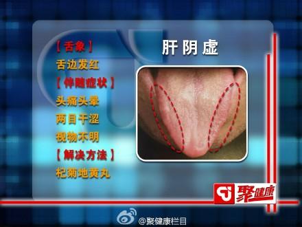肝脏者,在体合筋,其华在爪;在窍为目,在液为泪;体阴而用阳.