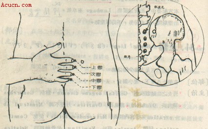 艾灸治療盆腔炎盆腔積液附件炎宮頸炎附穴位圖