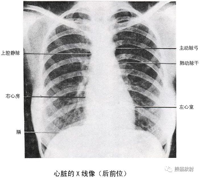 正常心脏和大血管的x线表现