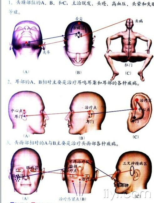 八字療法對應圖