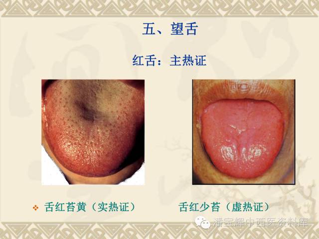 舌诊中医四诊望诊之舌诊