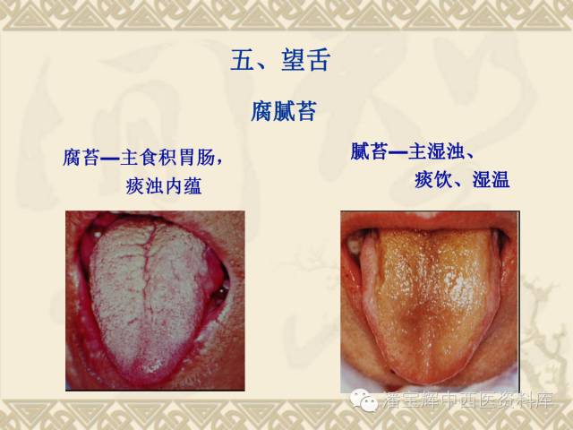 舌诊中医四诊望诊之舌诊