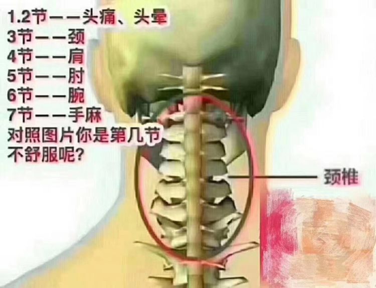 是人體的十字路口,有著承上啟下的作用,大椎穴不通,會堵塞七條經絡,可