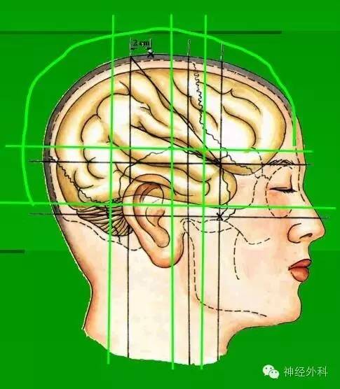 矢状线:眉间至枕外隆凸的连线.