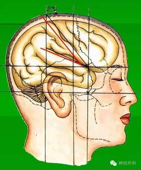 颅脑之重 ▏骨性标志& 标志线& 体表投影