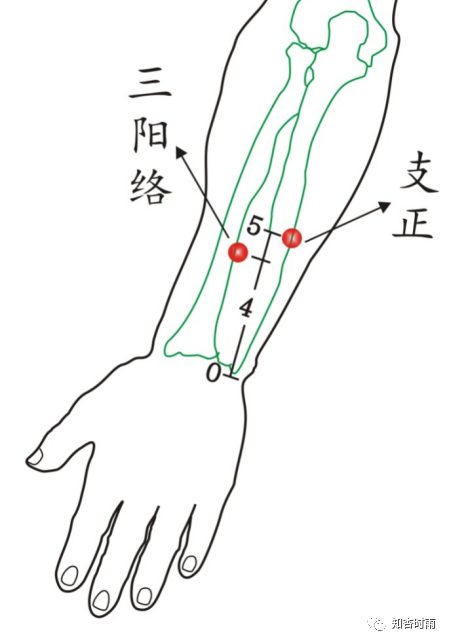 眼瞼痙攣:1.三陽絡,支正.2.美容四穴( 陰郄 少海 陰陵泉 隱白).