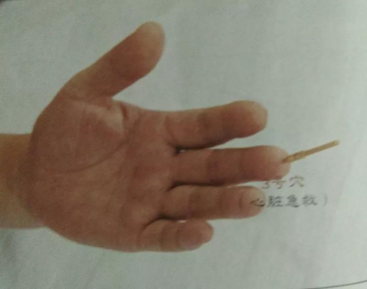 百忍堂独针针法汇编