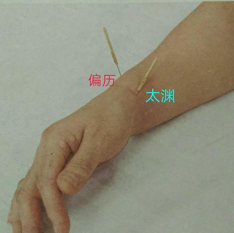 百忍堂独针针法汇编