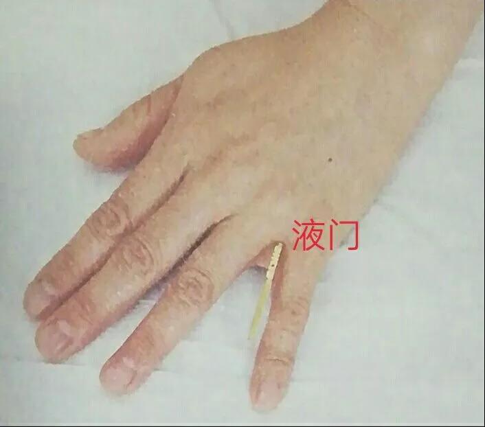 百忍堂独针针法汇编