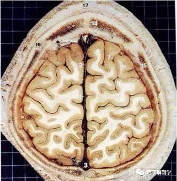 經典大體顱腦斷層解剖圖橫斷面
