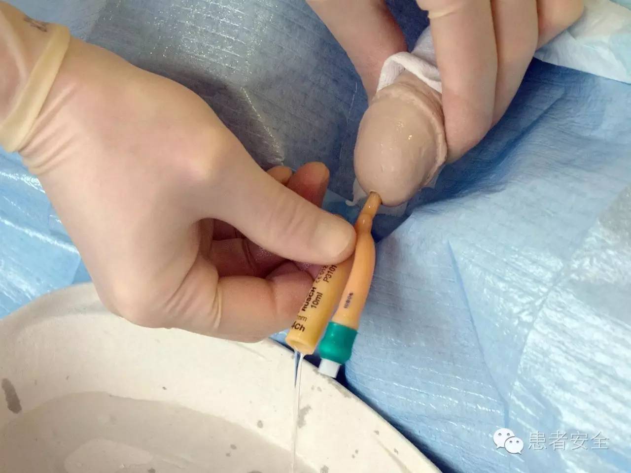 患者安全运用cusp工具包降低导尿管相关尿路感染