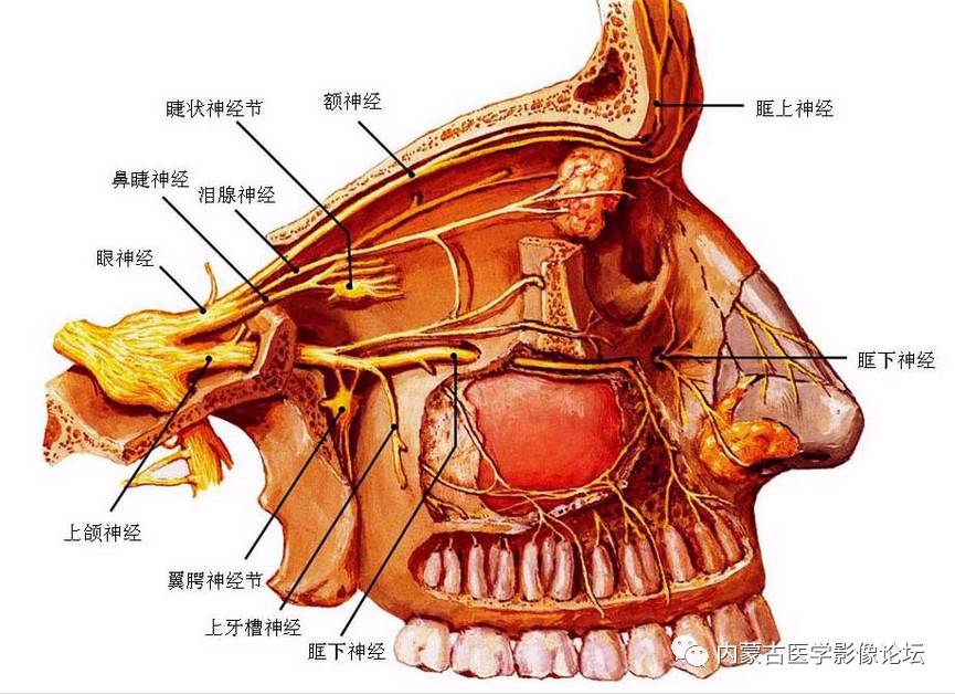 上颌窦裂孔图片
