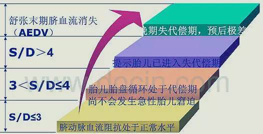 脐血流sd比值是什么