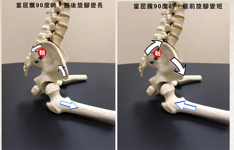 骨盆前旋的机理与纠正手法操作