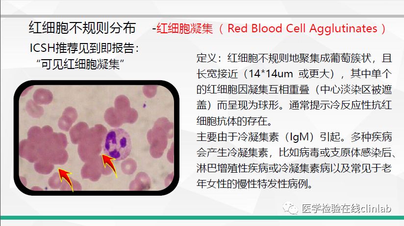 19講座視頻外周血紅細胞形態標準化報告和病例分析