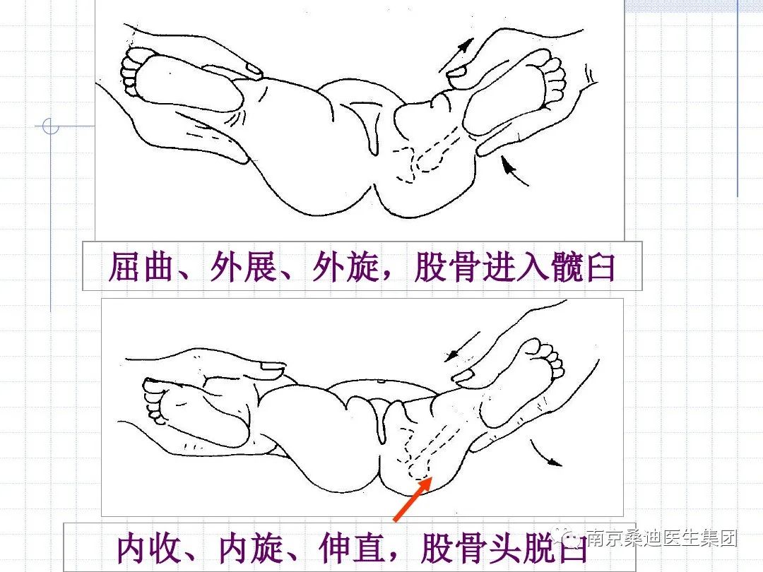 魏老师 13718030904(微信 7月6日龙氏正骨(治脊疗法)手法复位精