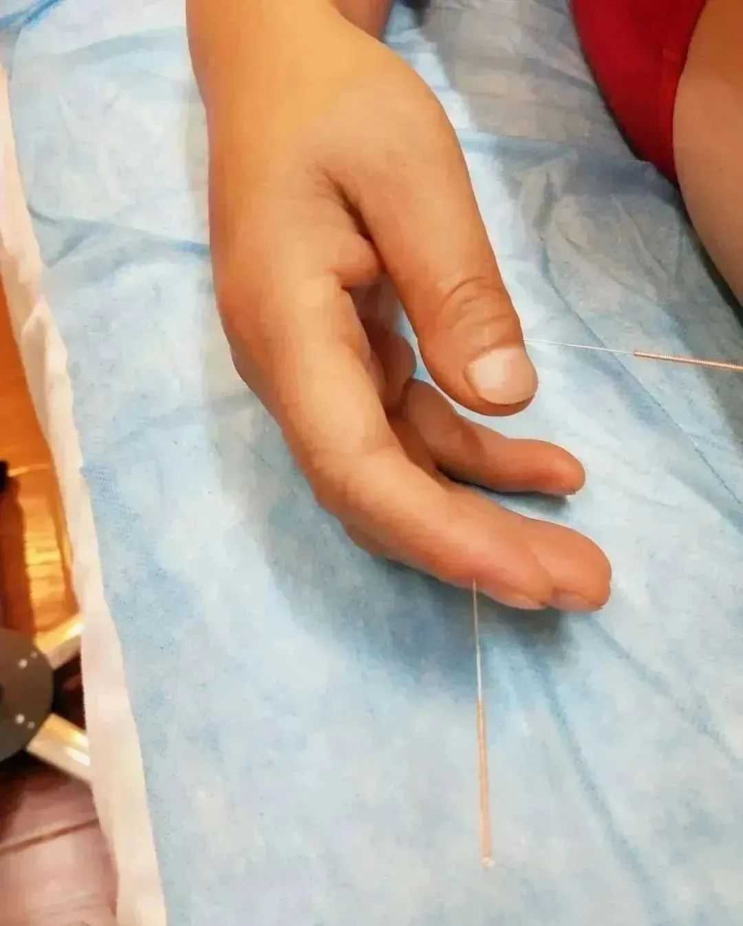 针灸名家金伯华手针治痛简单又实用