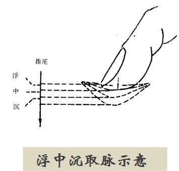 直出平行脉图片