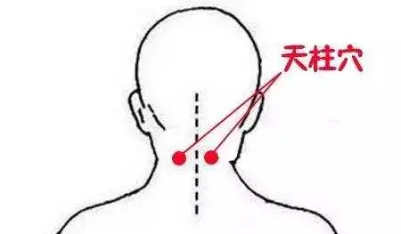 2,老年痴呆 3,治療眼睛乾澀 天柱穴 位於後頭骨正下方凹處