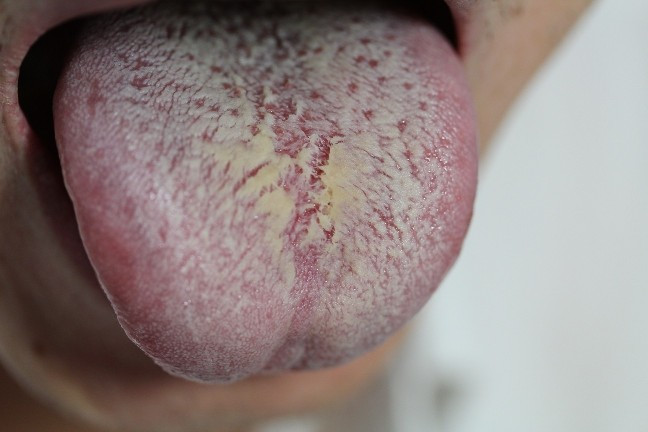 李玉宾老师讲舌诊