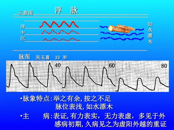 脉诊图解大全28种脉象让你快速掌握脉诊