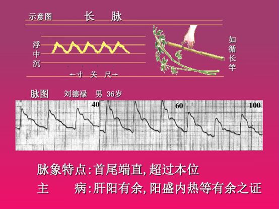 脉诊图解大全28种脉象让你快速掌握脉诊