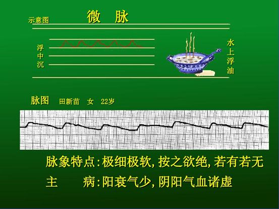 脉诊图解大全28种脉象让你快速掌握脉诊