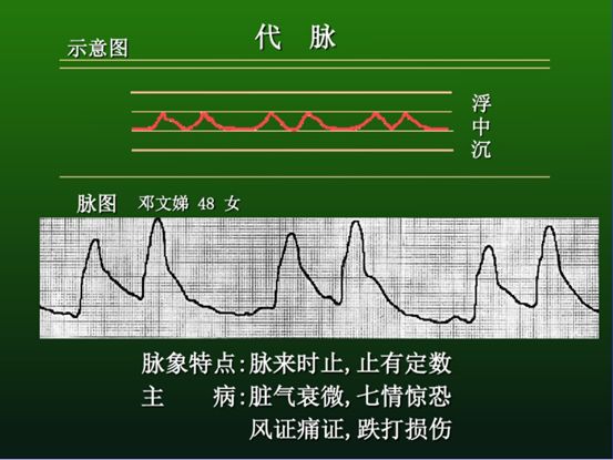 革脉【脉象特征】浮而博指,中空外坚,如按鼓皮.