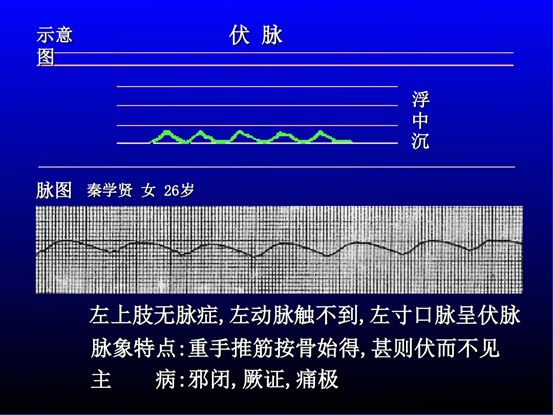 脉诊图解大全28种脉象让你快速掌握脉诊