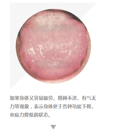 5  滑苔——精神不济糙苔微津液亏损之重症.