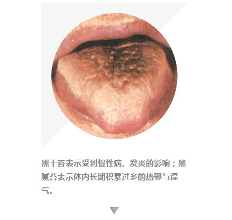 看舌头可辨病!100多张高清舌诊图谱,值得收藏!