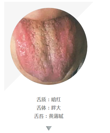 看舌头可辨病100多张高清舌诊图谱值得收藏