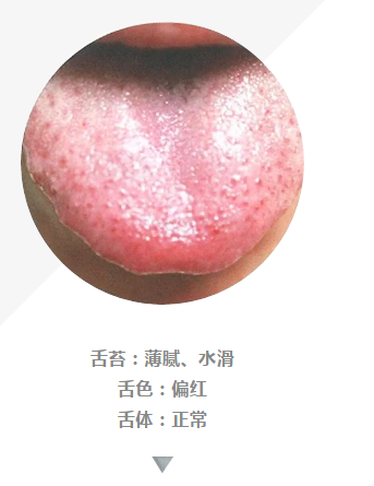 看舌头可辨病!100多张高清舌诊图谱,值得收藏!