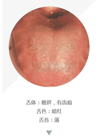 看舌头可辨病100多张高清舌诊图谱值得收藏
