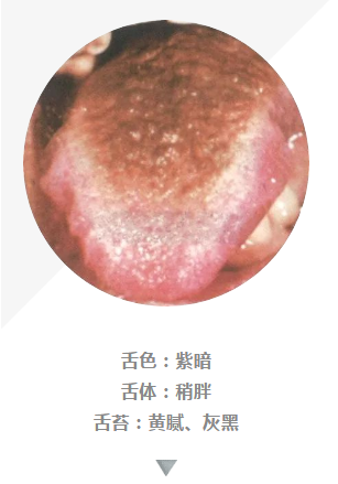 看舌頭可辨病100多張高清舌診圖譜值得收藏