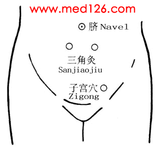 艾灸治疗妇科病(附穴位图)转载 - 好网角收藏夹