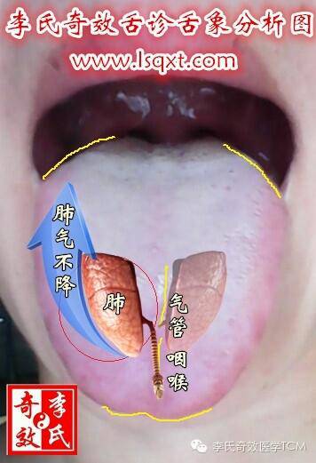 珍贵资料奇效舌诊舌苔篇系列讲座秘传舌诊心法首次公开