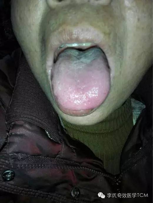 珍贵资料奇效舌诊舌苔篇系列讲座秘传舌诊心法首次公开