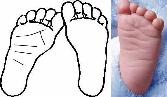 脚纹, 首先要来看脚纹,脚下的纹理主要指脚心部分的纹理,如果脚下无