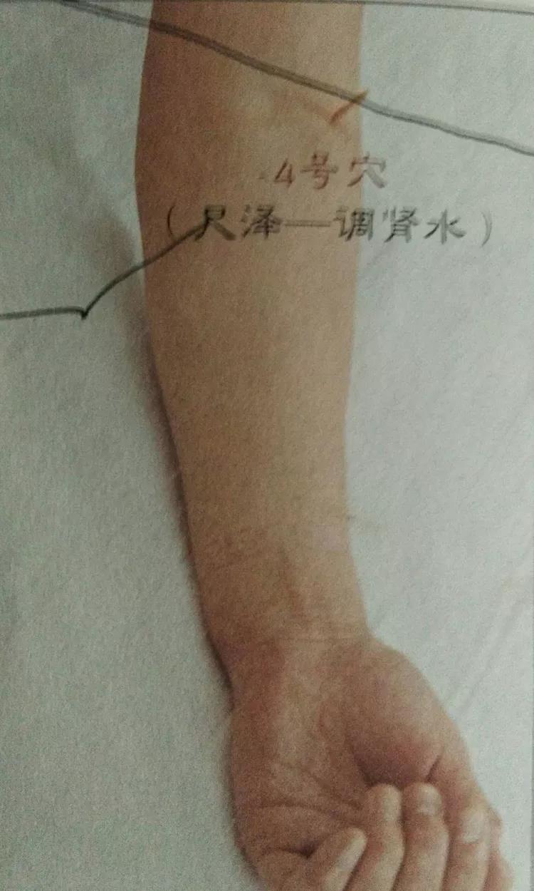 百忍堂独针针法汇编