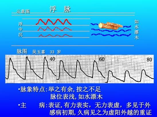 脉诊图解大全28种脉象让你快速掌握脉诊